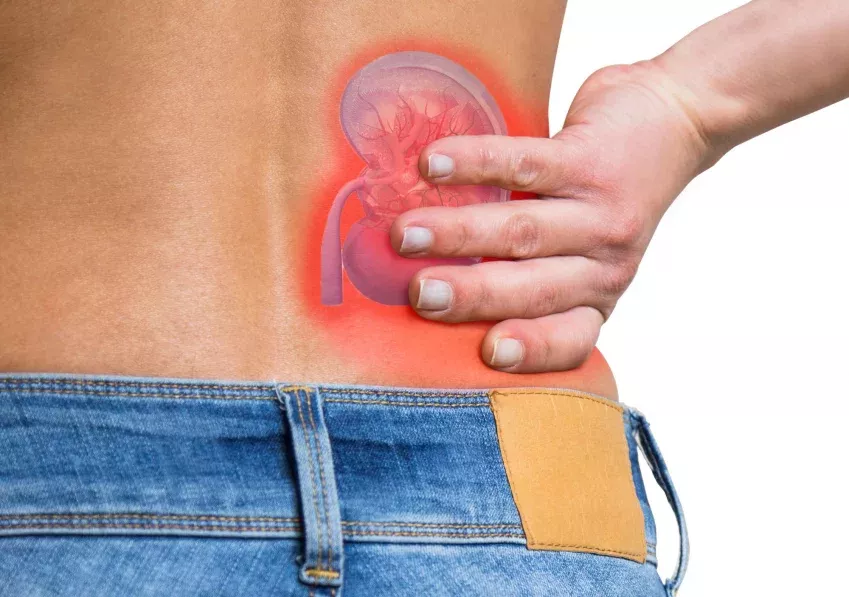 Imagen explicativa sobre la enfermedad renal crónica, proporcionada por el Dr. Antonio Moreno, especialista en nefrología en Cádiz, para ayudar a entender esta condición. Imagen explicativa sobre la enfermedad renal crónica, proporcionada por el Dr. Antonio Moreno, especialista en nefrología en Cádiz, para ayudar a entender esta condición.