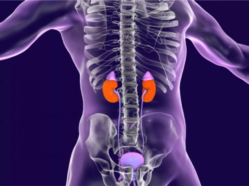 enfermedad renal cronica dr antonio moreno cadiz
